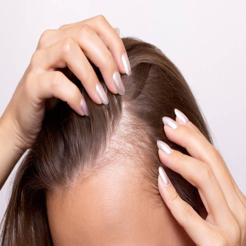 How AI-Powered Scalp Scanners Are Changing the Hair Loss Industry？