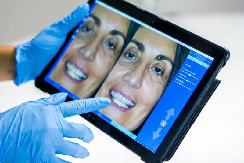 Unlock Your Real Skin Condition with AI Skin Analyzer Machine