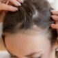 Can a Hair and Scalp Analyzer Detect Hair Loss Early?