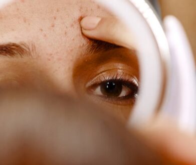 What Skin Conditions Can AI Skin Imaging Devices Detect?