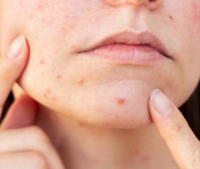 Multispectral Light Analysis in Professional Skin Diagnostic Equipment Systems